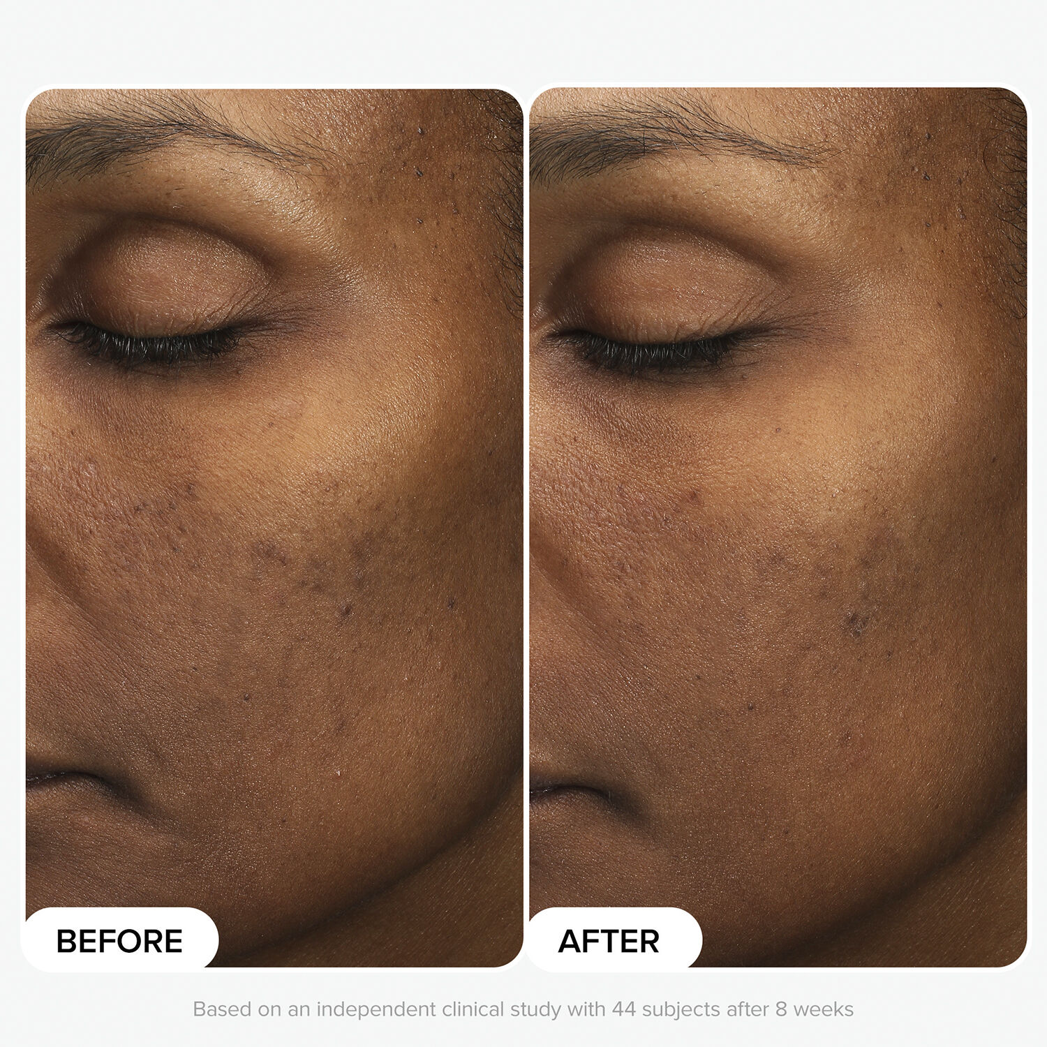 Multi-Level Exfoliation Trial Kit