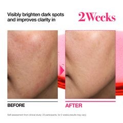Niacinamide 10 + TXA 4 Serum, ANUA