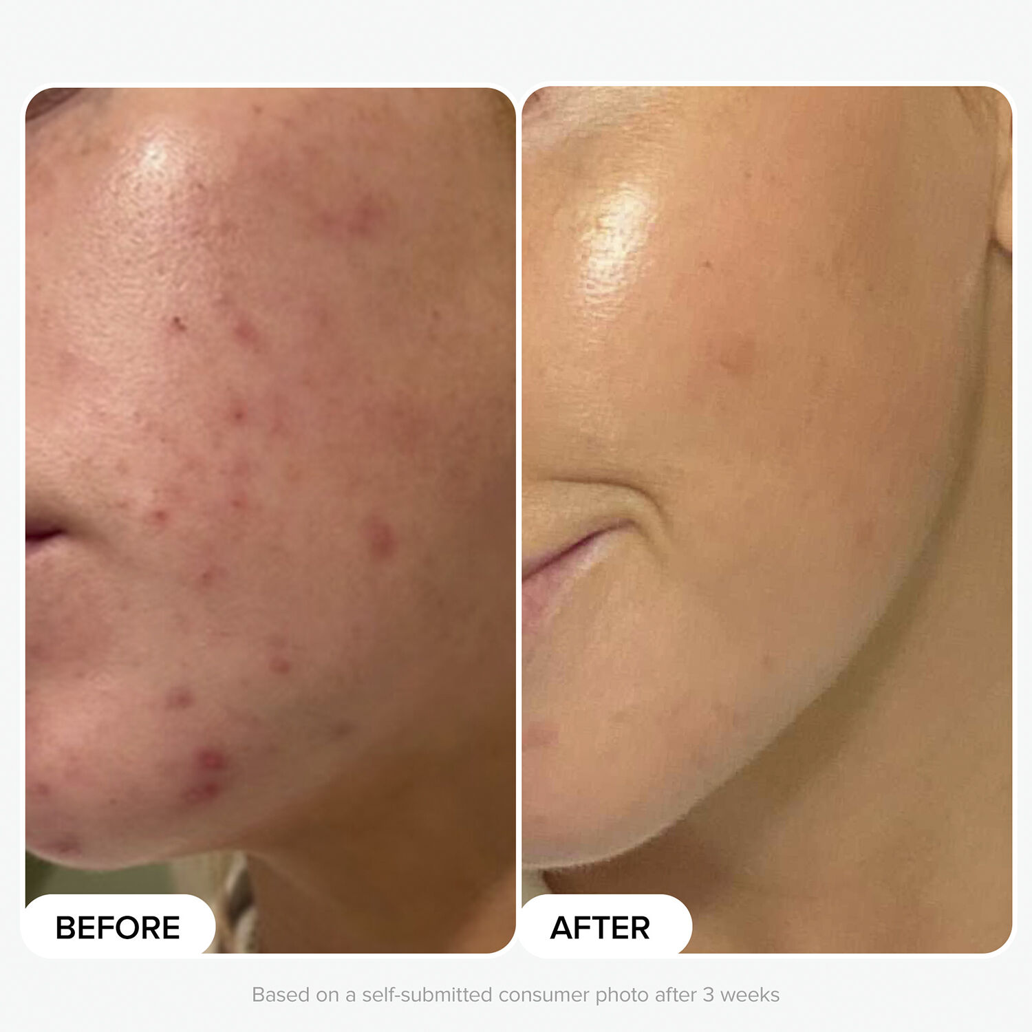 Multi-Level Exfoliation Trial Kit