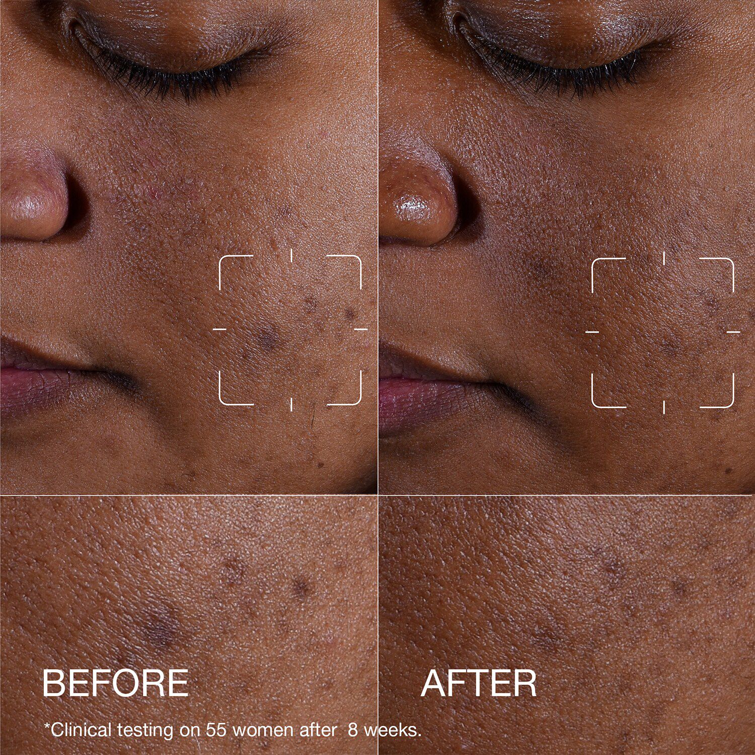 Even Better Clinical™ Dark Spot Clearing Serum